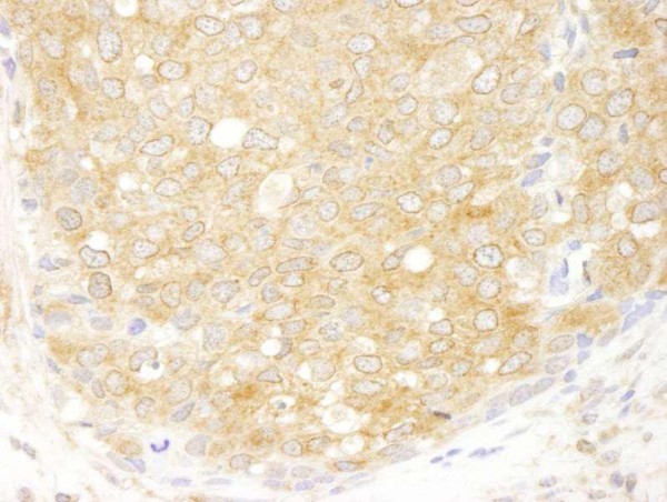 Anti-eIF2beta/EIF2S2 (IHC)