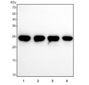 Anti-Thymidylate kinase / DTYMK, clone 29D22