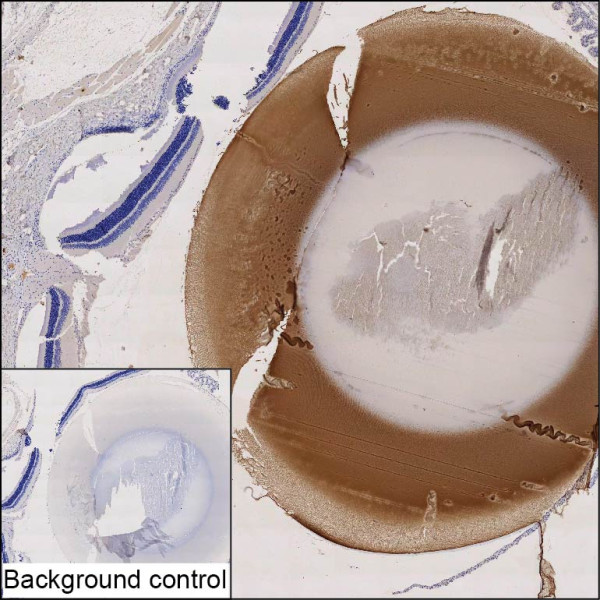 Anti-alpha A Crystallin