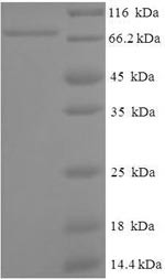 ATP-dependent RNA helicase A (DHX9), partial, human, recombinant