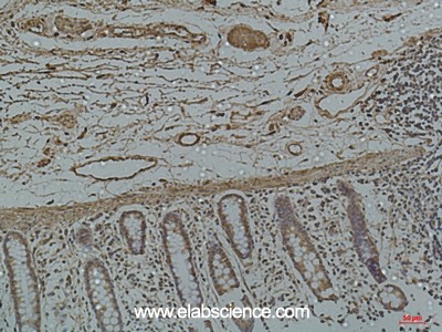 Anti-Galectin 3, clone 8D7