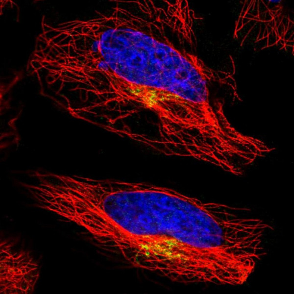 Anti-ATP7A