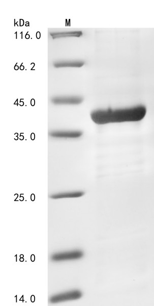 Non-receptor tyrosine-protein kinase TYK2 (TYK2), partial, human, recombinant