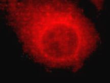 Anti-ATP Citrate Lyase, clone 3D9-E9-H8, C-terminal