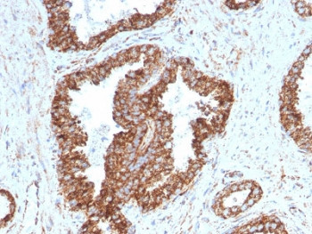 Anti-TMEPAI / PMEPA1, clone PMEPA1/2698