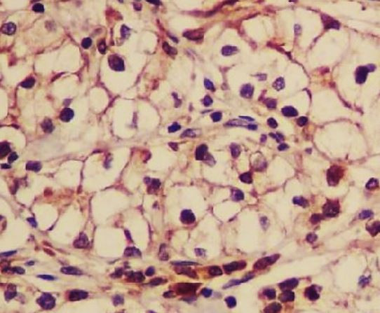 Anti-CD13