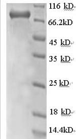Rab GDP dissociation inhibitor beta (GDI2), partial, recombinant human