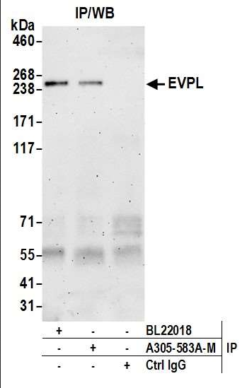 Anti-EVPL
