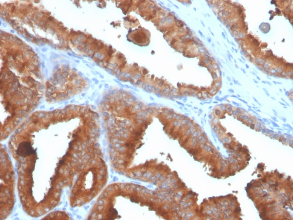 Anti-Prostate Specific Antigen (PSA), recombinant antibody, clone rKLK3/4753