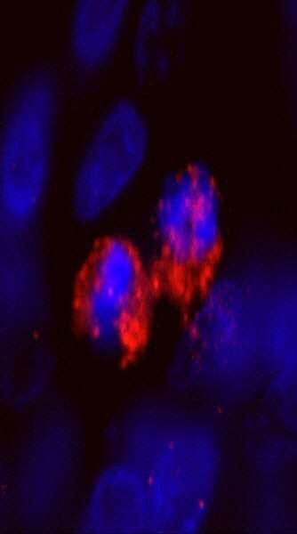 Anti-CENP-F/Mitosin (IHC)