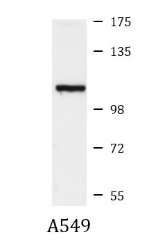 Anti-LPIN2 / Lipin 2