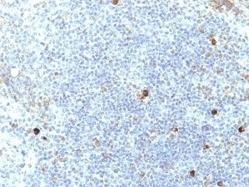 Anti-HLA-Aw32 + HLA-A25, clone SPM417