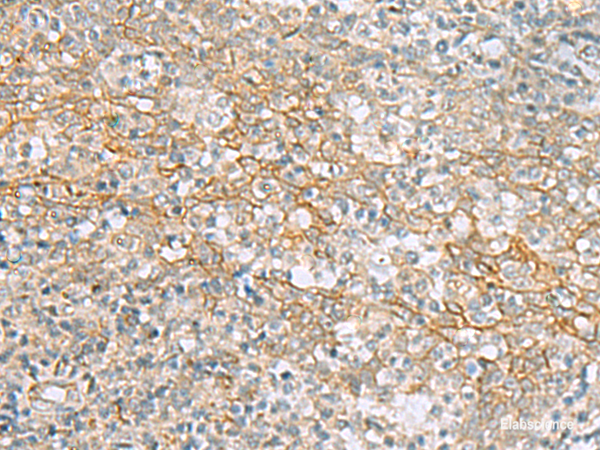 Anti-KCNH7