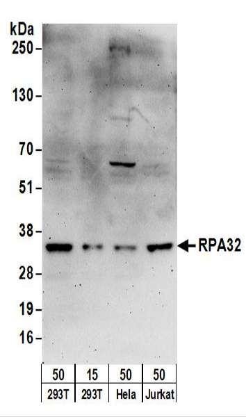 Anti-RPA32