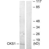 Anti-CKS1B