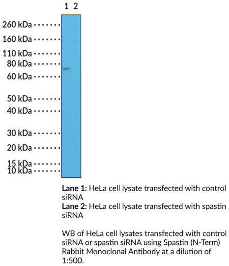 Anti-Spastin (N-Term) Rabbit Monoclonal Antibody (Clone RM346)