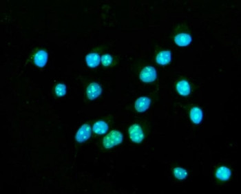 Anti-CENPB / Major centromere autoantigen B