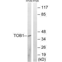 Anti-TOB1 (Ab-164)