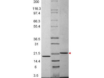 Interleukin-29, human recombinant (rHuIL-29)