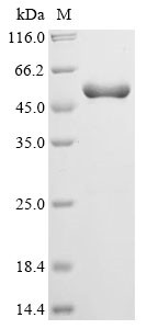 Serine/threonine-protein kinase Nek7 (NEK7), human, recombinant
