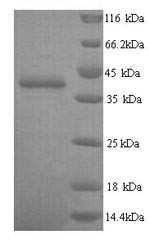 Talin-2 (TLN2), partial, human, recombinant