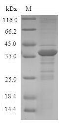 Protein S100-A12 (S100A12), human, recombinant