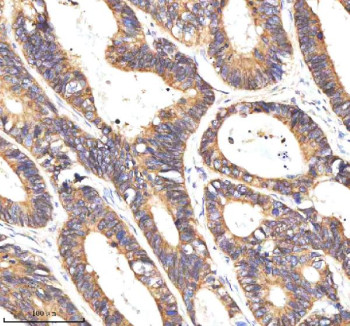 Anti-NAXE / NAD(P)HX epimerase