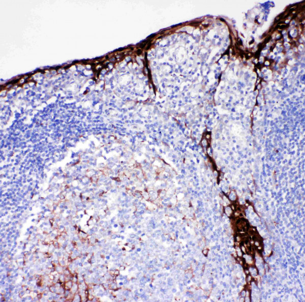 Anti-Cystatin A