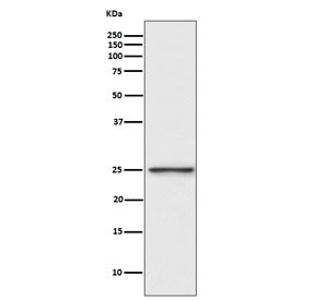 Anti-PGP9.5 / UchL1, clone AOCE-21