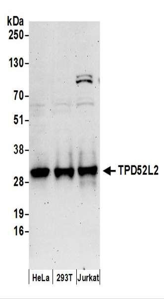 Anti-TPD52L2