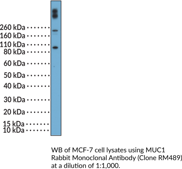 Anti-MUC1 Rabbit (Clone RM489)