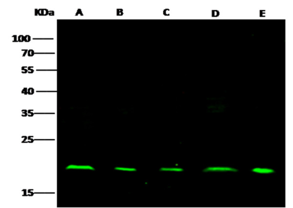 Anti-NME1/NDKA Monoclonal Recombinant Antibody