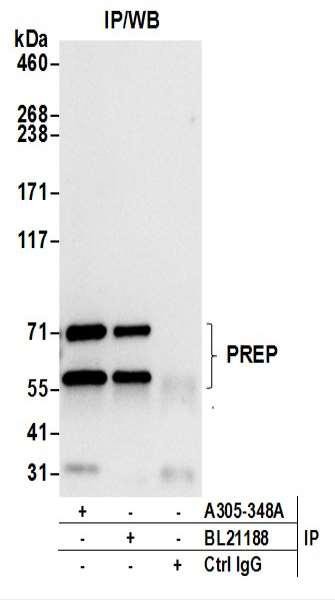 Anti-PREP/Prolyl Oligopeptidase