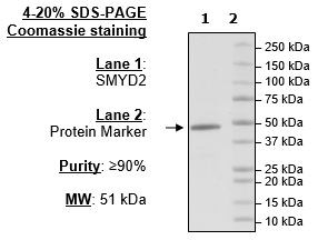 SMYD2, active human recombinant protein