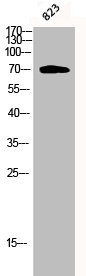 Anti-Phospho-PRKCZ (T410)