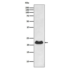 Anti-Alpha B Crystallin / CRYAB, clone ABHC-3