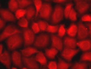 Anti-Selenium Binding Protein 1