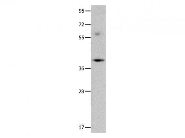 Anti-OPCML