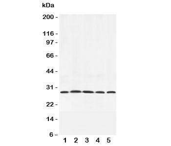 Anti-Adiponectin