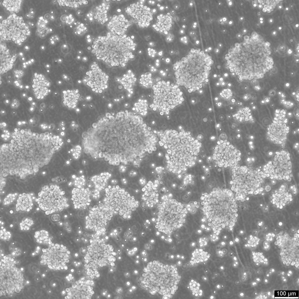 RAJI Cells