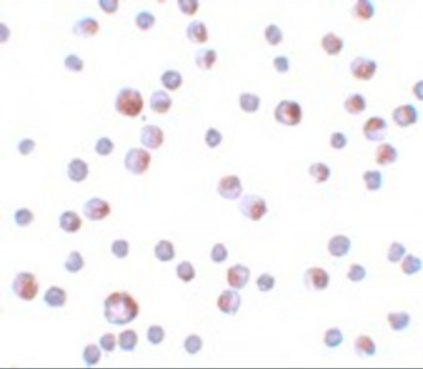 Anti-TCTN3