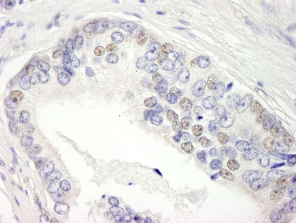 Anti-BRD3 (IHC)