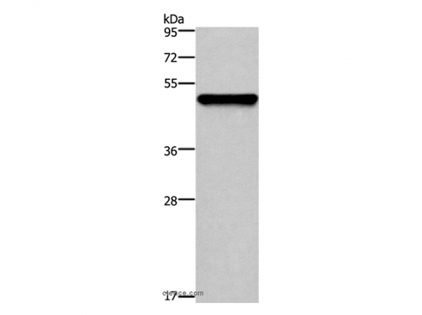 Anti-KRT14