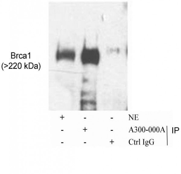 Anti-BRCA1