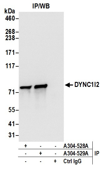 Anti-DYNC1I2