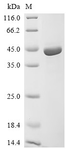 Adipocyte plasma membrane-associated protein (APMAP), partial, human, recombinant