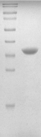 Recombinant Human UbE2R2