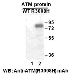 Anti-ATM (R3008H)