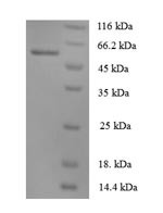 Angiopoietin-1 (ANGPT1), human, recombinant