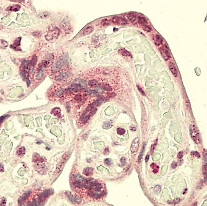 Anti-ERVW1 / Syncytin 1